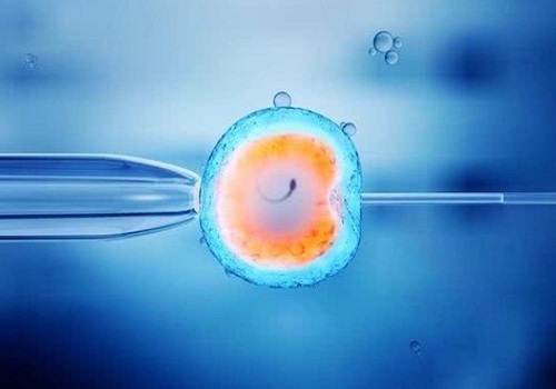 美国试管婴儿专家科普：关于多囊卵巢综合征(PCOS)的5个知识点