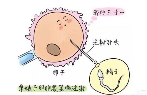 试管婴儿方案有哪几种？具体内容是什么？