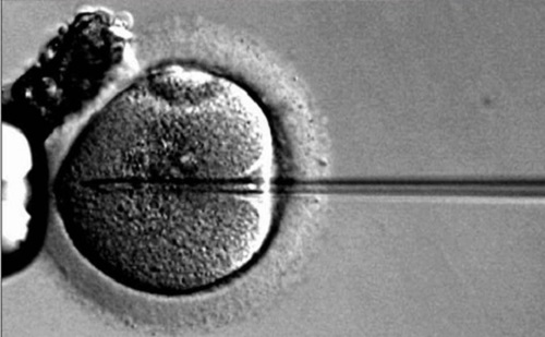 美国试管婴儿之卵泡监测的必要